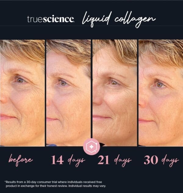 Collagen Visible Benefits Assets_Visible Results-13