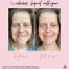 Collagen Visible Benefits Assets_Visible Results-14