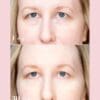 Collagen Visible Benefits Assets_Visible Results-15