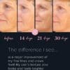 Collagen Visible Benefits Assets_Visible Results-16