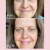 Collagen Visible Benefits Assets_Visible Results-17