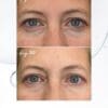 Collagen Visible Benefits Assets_Visible Results-18