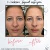 Collagen Visible Benefits Assets_Visible Results-20