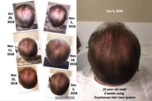 LifeVantage Hair Care system results 2