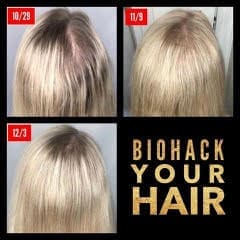 Risultati del sistema LifeVantage per la cura dei capelli 5